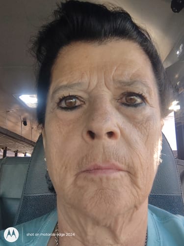 Customer photo review of Reverse-aging Adaptive Foundation